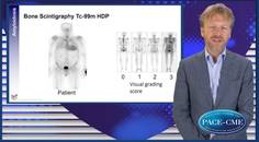 Cardiac amyloidosis an emerging target in HFpEF