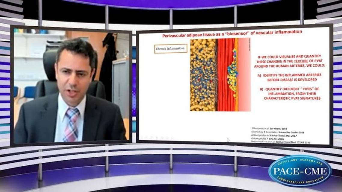 Detecting residual cardiovascular risk using coronary CT angiography