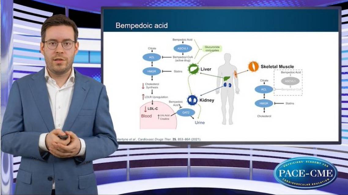 Lipid management and the potential role of bempedoic acid