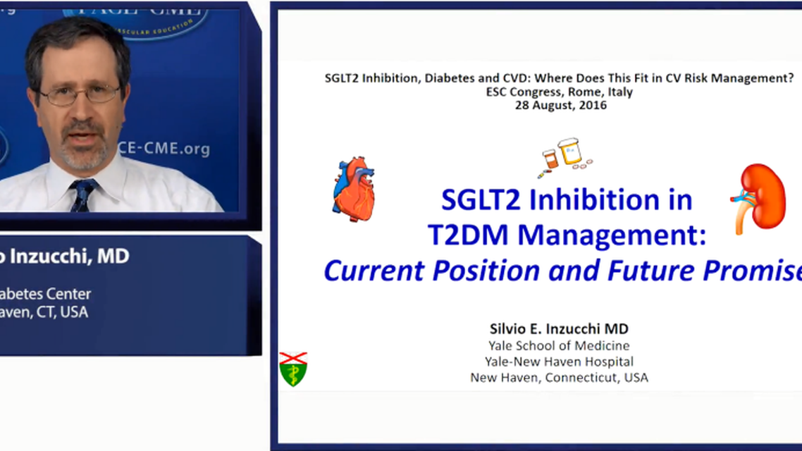 Overview of SGLT inhibitors in TDM management current position future promise