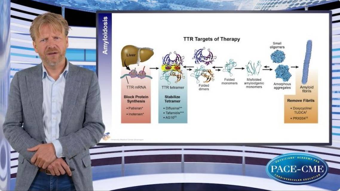 How to diagnose and treat amyloidosis