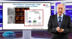 Challenges when targeting inflammation in residual CV risk