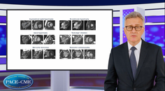 HCM Understanding the condition