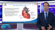 diagnostic challenges HCM