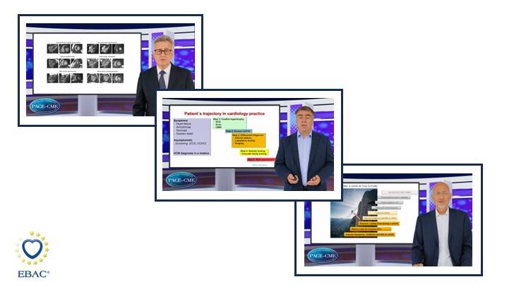 Emerging perspectives in the diagnosis and management of hypertrophic cardiomyopathy