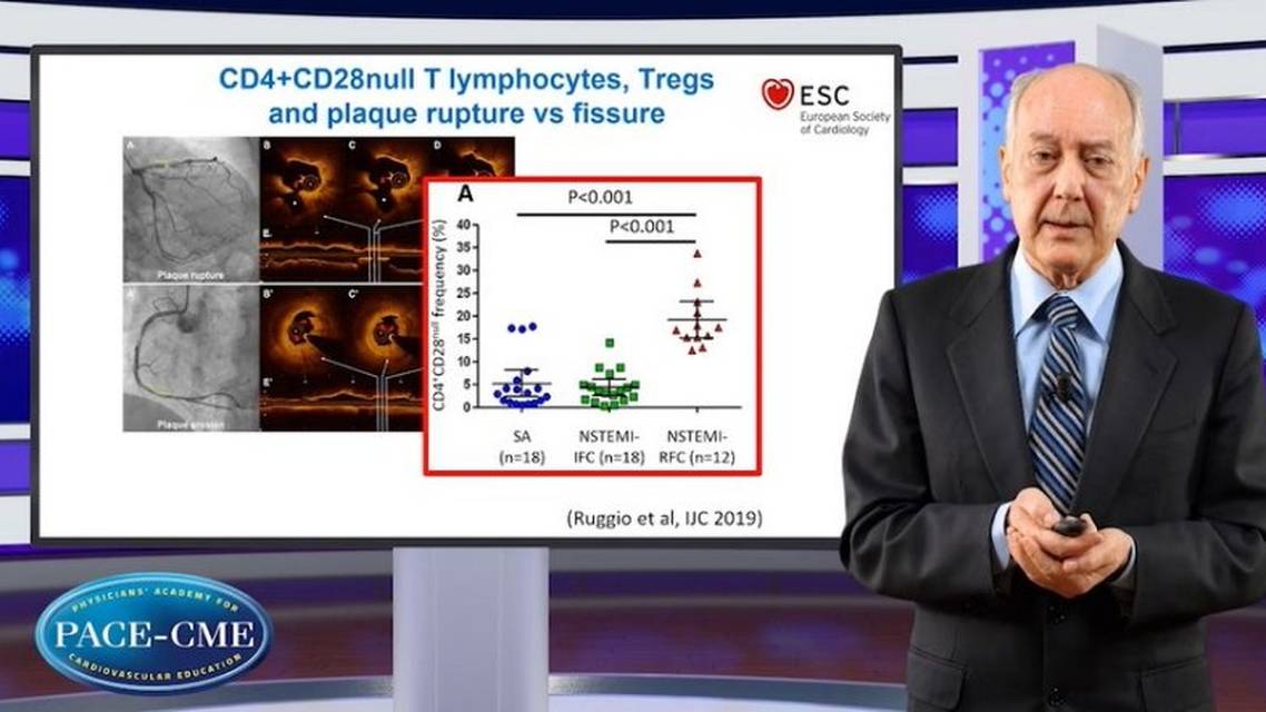 Challenges when targeting inflammation in residual CV risk