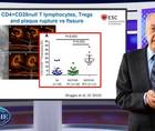 Challenges when targeting inflammation in residual CV risk