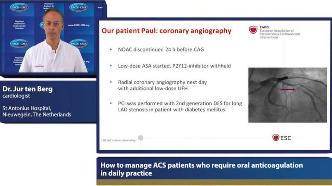 Treatment of patients on oral anticoagulation who present with ACS