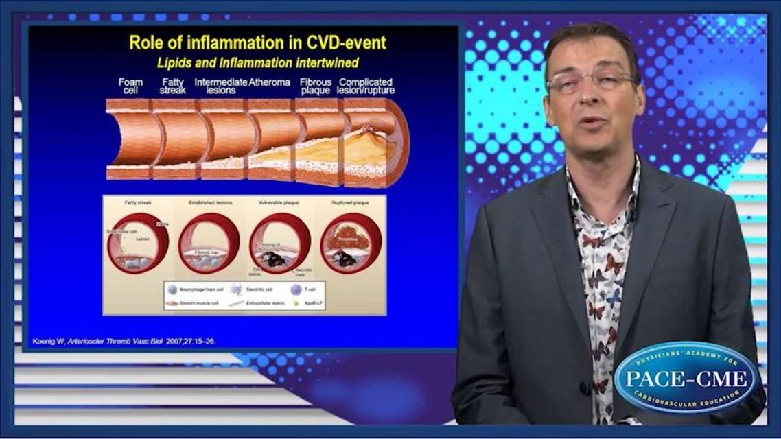 Cardiovascular disease in diabetes and CKD residual risk The promise of epigenetics